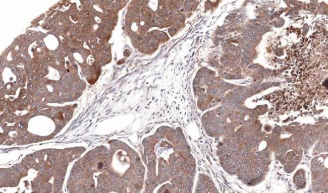 CDA Antibody in Immunohistochemistry (Paraffin) (IHC (P))