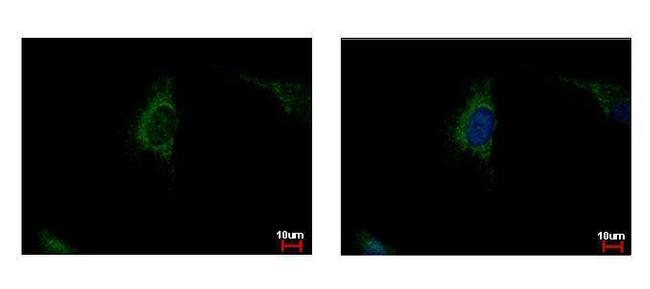 SDHA Antibody in Immunocytochemistry (ICC/IF)