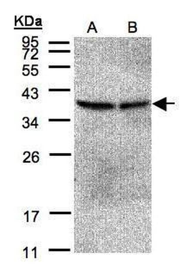 PP2A beta Antibody in Western Blot (WB)