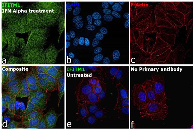 IFITM1 Antibody in Immunocytochemistry (ICC/IF)