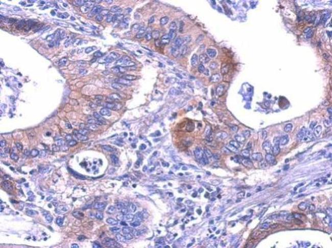 LDHB Antibody in Immunohistochemistry (Paraffin) (IHC (P))