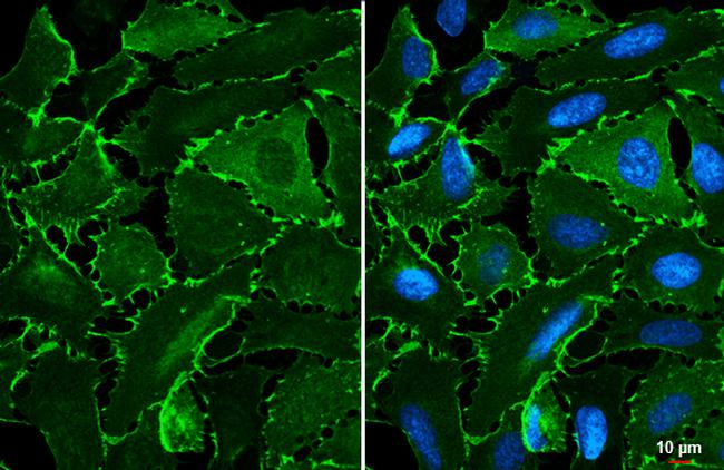 EPB41L3 Antibody in Immunocytochemistry (ICC/IF)