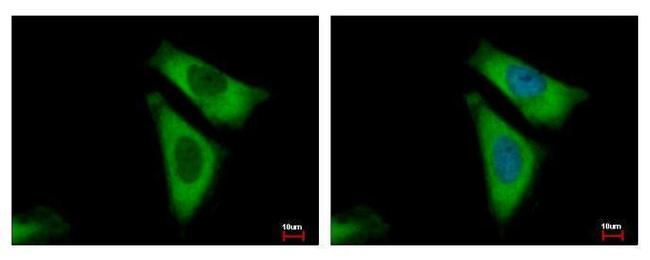 RPL29 Antibody in Immunocytochemistry (ICC/IF)