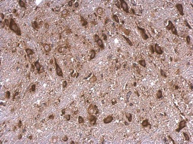 RPS15 Antibody in Immunohistochemistry (Paraffin) (IHC (P))