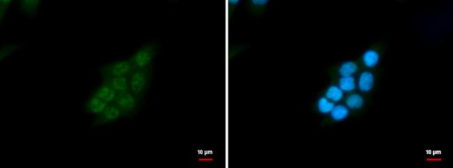 SNRPD2 Antibody in Immunocytochemistry (ICC/IF)