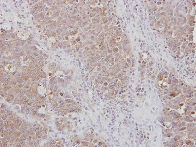 RPL3 Antibody in Immunohistochemistry (Paraffin) (IHC (P))