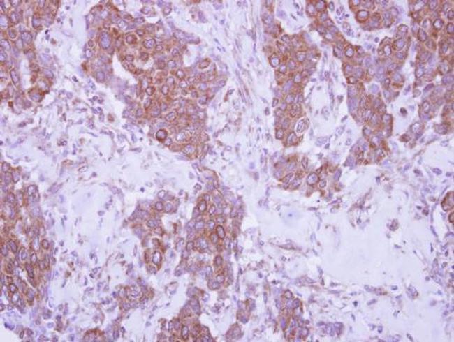 CD79b Antibody in Immunohistochemistry (Paraffin) (IHC (P))