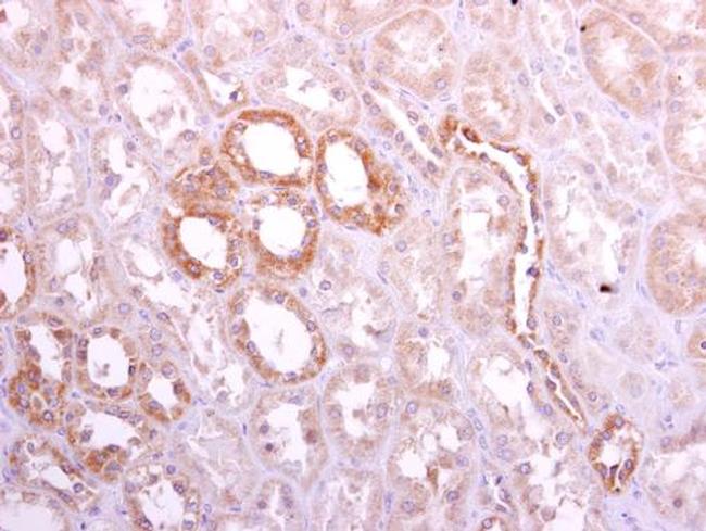 Ribophorin I Antibody in Immunohistochemistry (Paraffin) (IHC (P))