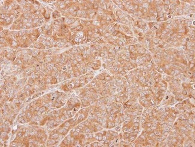 ZNHIT1 Antibody in Immunohistochemistry (Paraffin) (IHC (P))