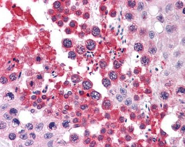 RUVBL2 Antibody in Immunohistochemistry (Paraffin) (IHC (P))