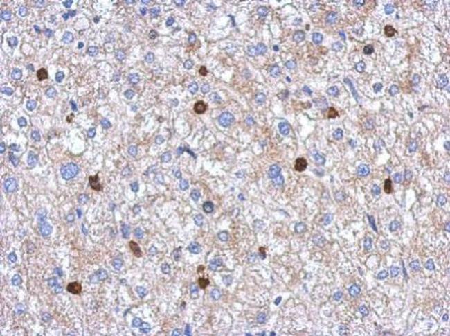 MYST2 Antibody in Immunohistochemistry (Paraffin) (IHC (P))