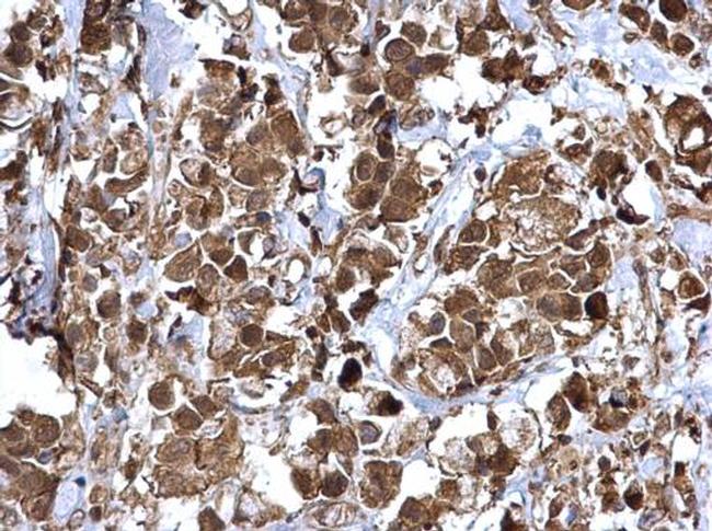 NFkB p65 Antibody in Immunohistochemistry (Paraffin) (IHC (P))