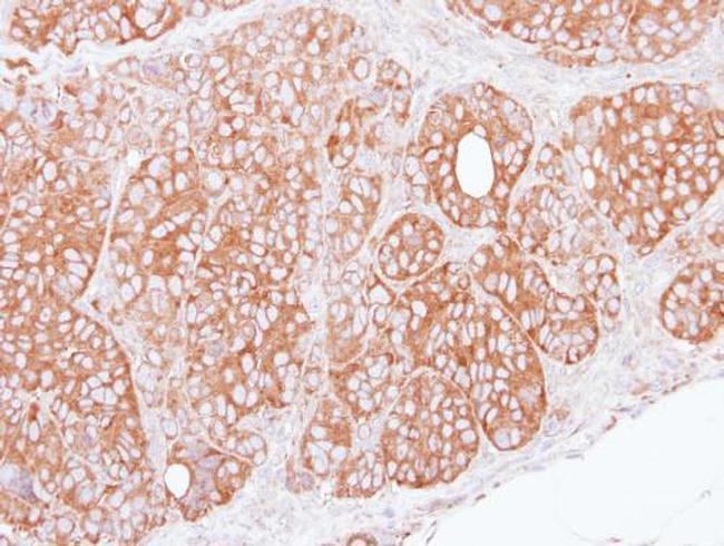 TRIM27 Antibody in Immunohistochemistry (Paraffin) (IHC (P))