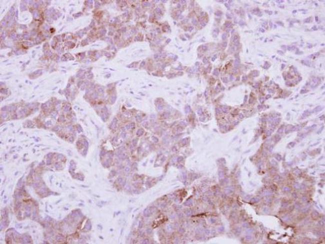 CPNE6 Antibody in Immunohistochemistry (Paraffin) (IHC (P))