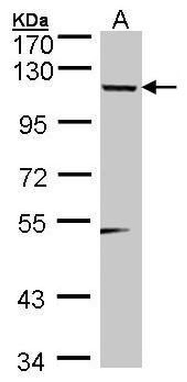 TSHZ1 Antibody in Western Blot (WB)