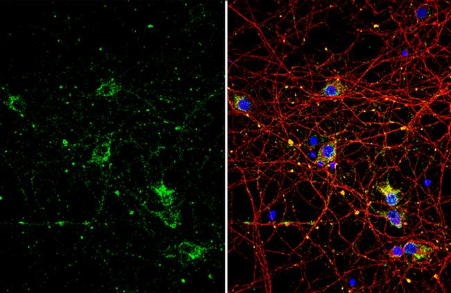 NGFR Antibody in Immunocytochemistry (ICC/IF)