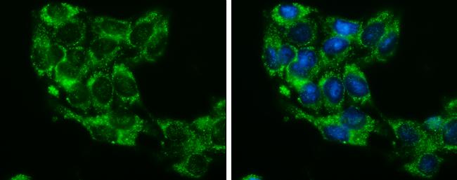 Glycerol kinase Antibody in Immunocytochemistry (ICC/IF)