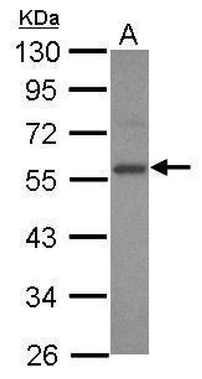 E2F3 Antibody in Western Blot (WB)