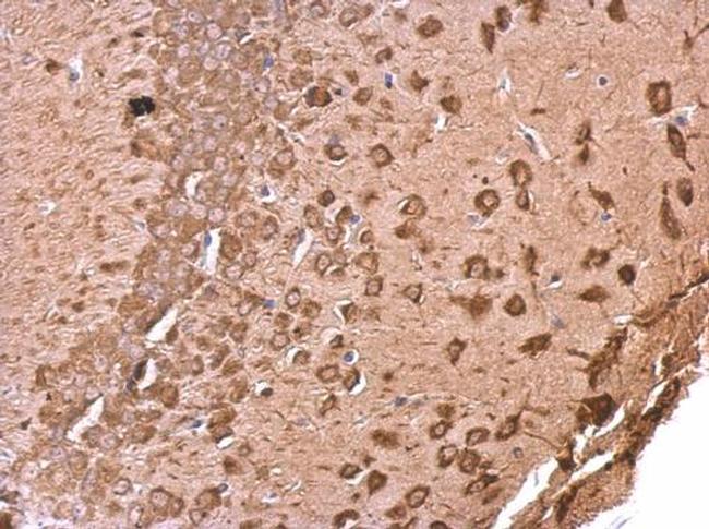 EEF1A2 Antibody in Immunohistochemistry (Paraffin) (IHC (P))