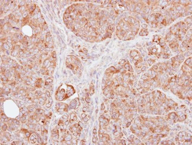 TRAF1 Antibody in Immunohistochemistry (Paraffin) (IHC (P))