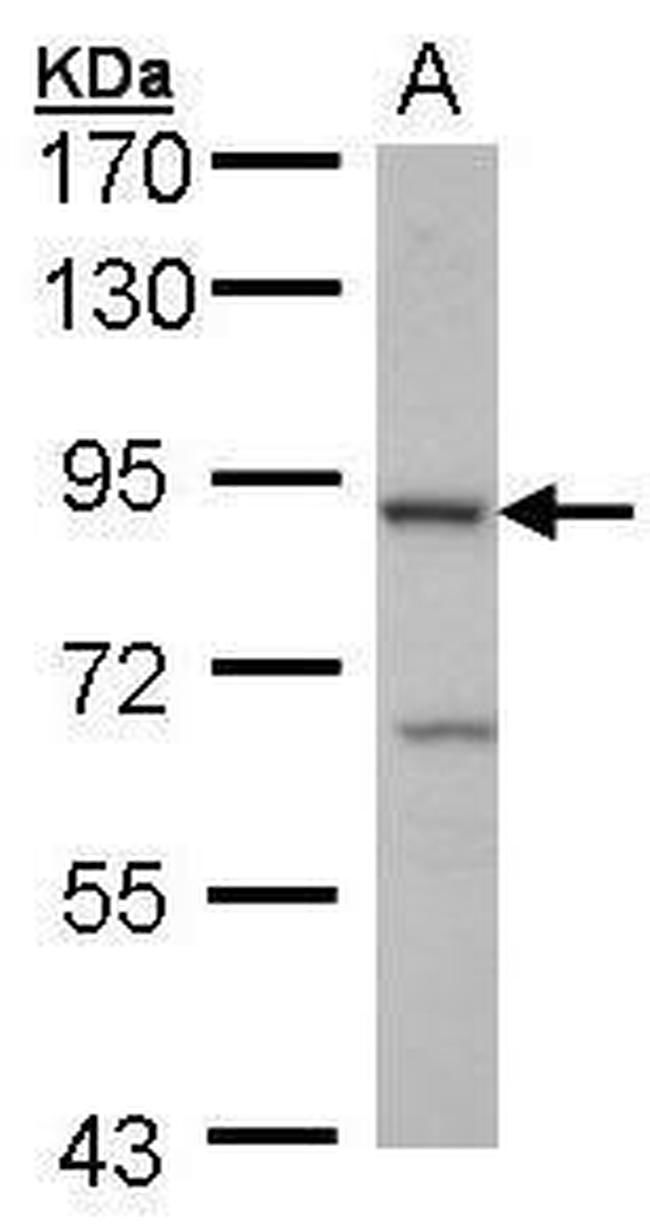 Cbl-b Antibody in Western Blot (WB)