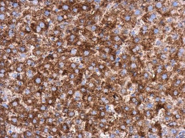 MEK1 Antibody in Immunohistochemistry (Paraffin) (IHC (P))