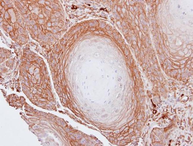 BAG3 Antibody in Immunohistochemistry (Paraffin) (IHC (P))