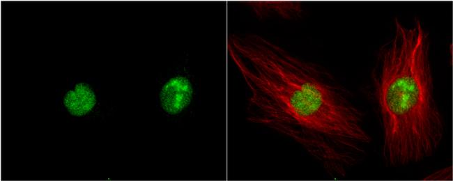 ZIPK Antibody in Immunocytochemistry (ICC/IF)