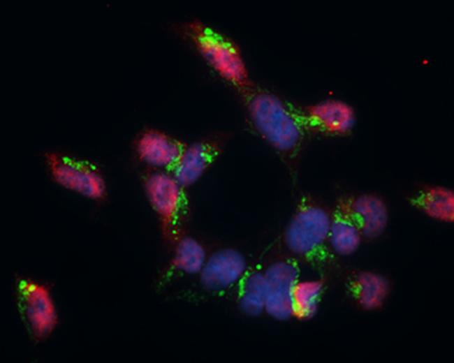 GABBR1 Antibody in Immunocytochemistry (ICC/IF)