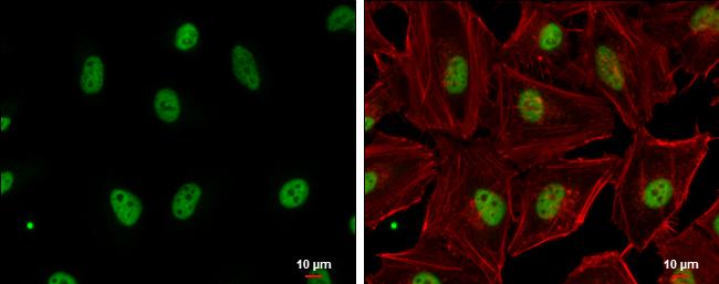 GABPA Antibody in Immunocytochemistry (ICC/IF)