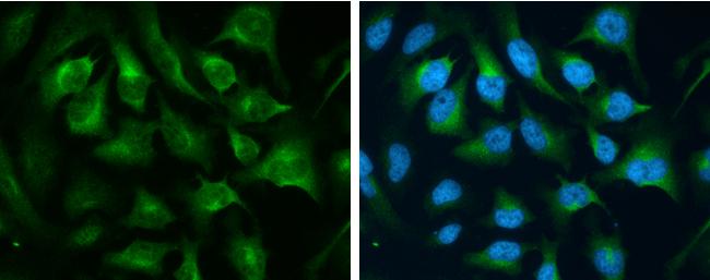 Transferrin Receptor Antibody in Immunocytochemistry (ICC/IF)