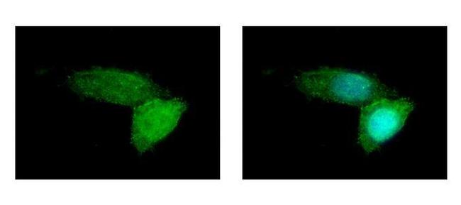 ABCB11 Antibody in Immunocytochemistry (ICC/IF)