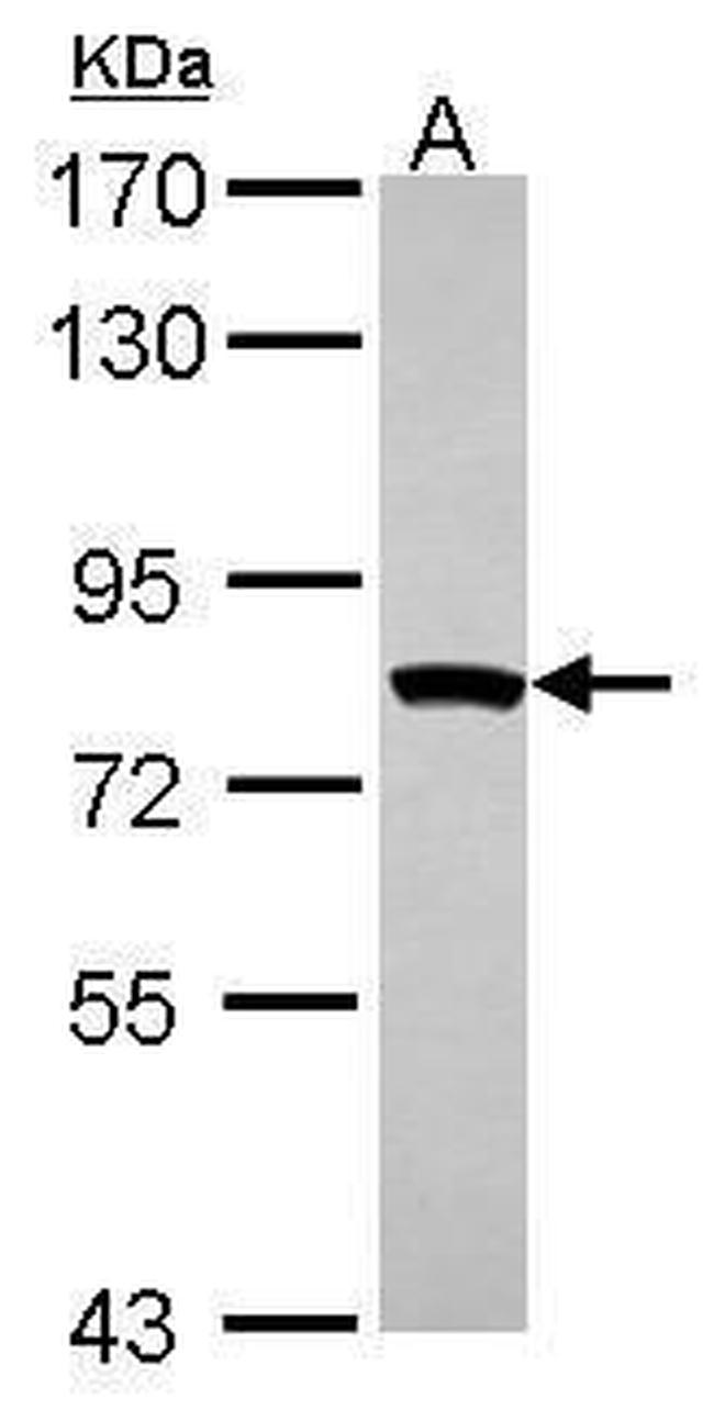 MTMR2 Antibody in Western Blot (WB)