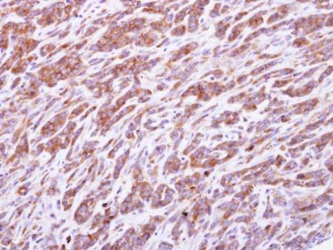 PRPS1 Antibody in Immunohistochemistry (Paraffin) (IHC (P))