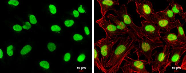 TOP2B Antibody in Immunocytochemistry (ICC/IF)