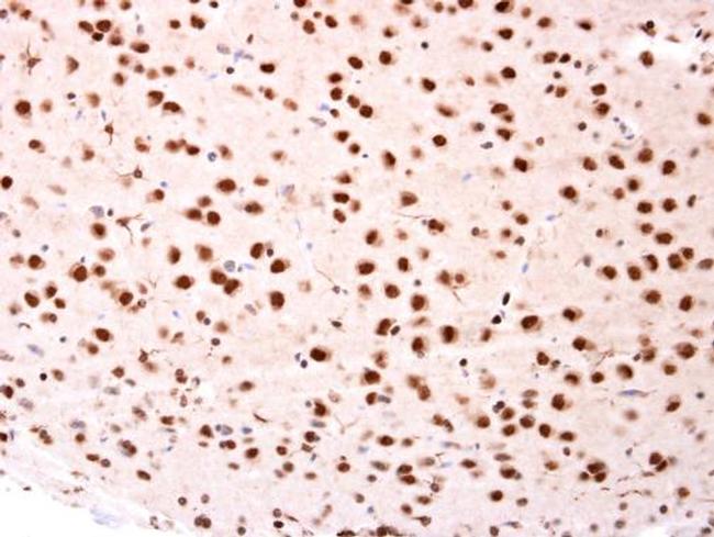 BTRC Antibody in Immunohistochemistry (Paraffin) (IHC (P))