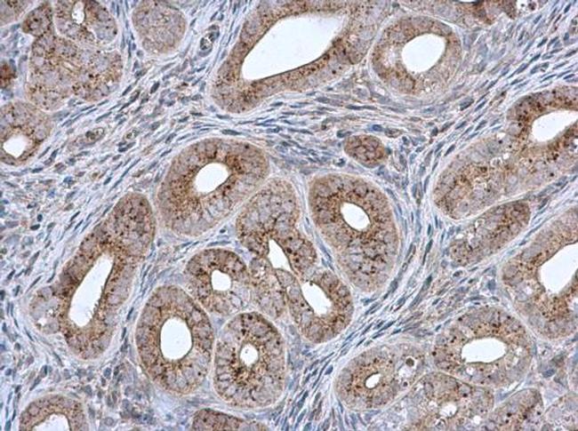 MCCC2 Antibody in Immunohistochemistry (Paraffin) (IHC (P))