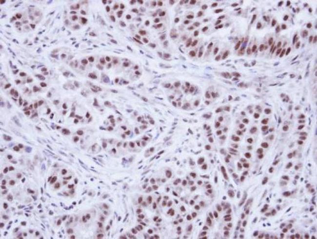 WTAP Antibody in Immunohistochemistry (Paraffin) (IHC (P))