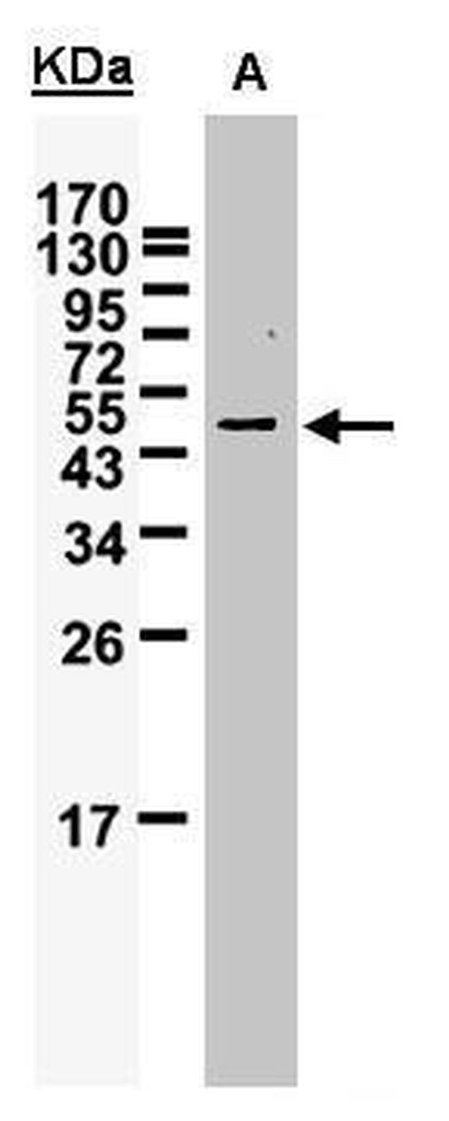 WTAP Antibody in Western Blot (WB)