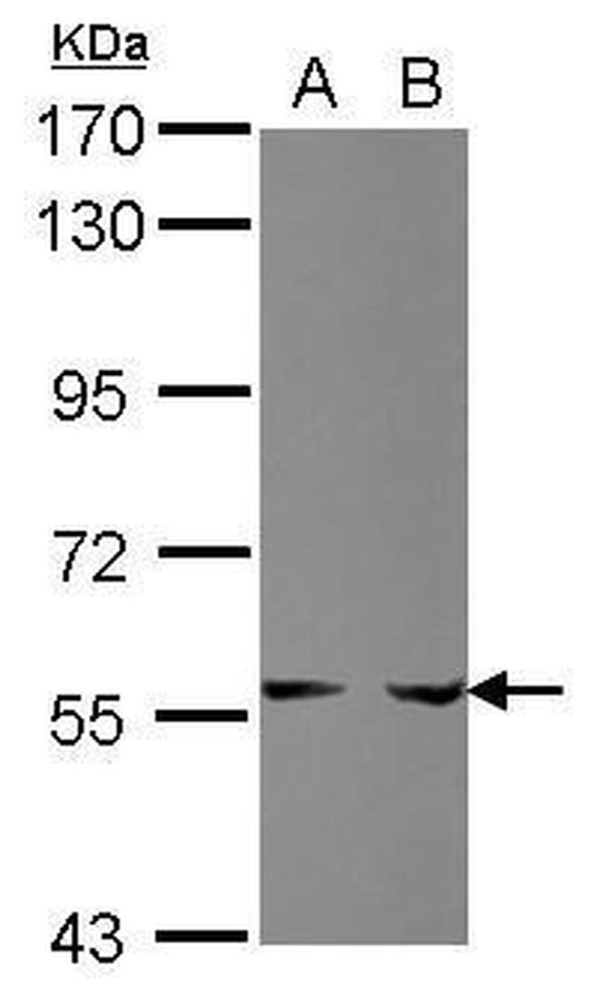 PPAT Antibody in Western Blot (WB)