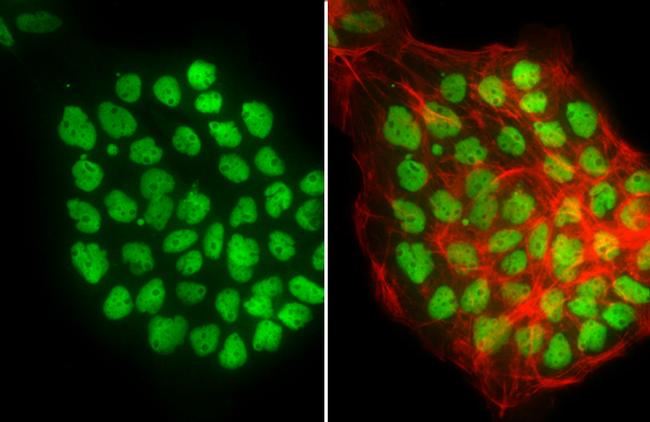 p53 Antibody in Immunocytochemistry (ICC/IF)