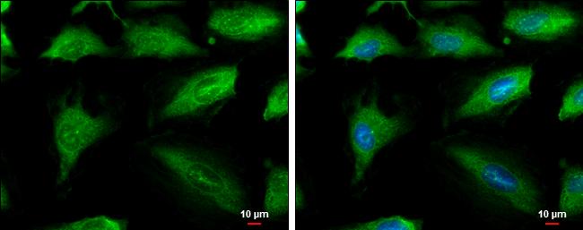 Aconitase 1 Antibody in Immunocytochemistry (ICC/IF)