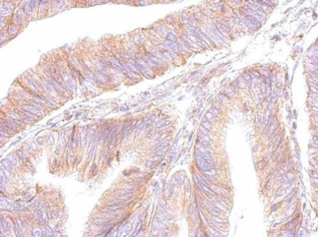 ATP Synthase B1 Antibody in Immunohistochemistry (Paraffin) (IHC (P))