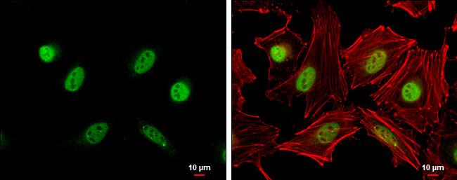 Cyclin A2 Antibody in Immunocytochemistry (ICC/IF)