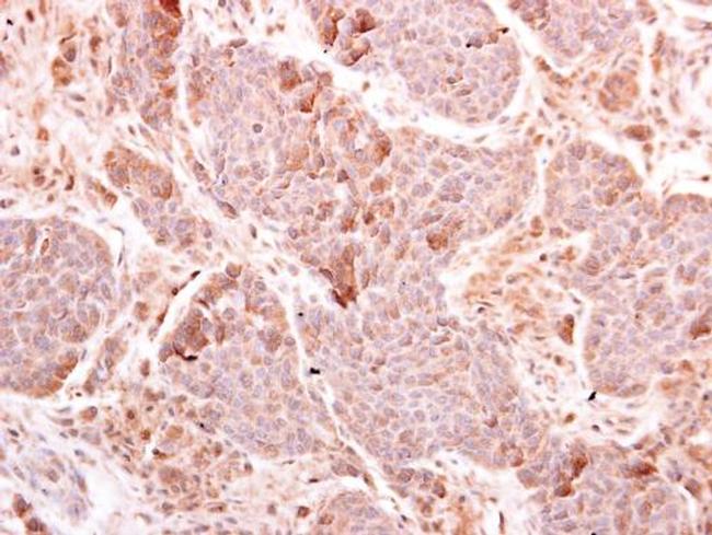 MDA5 Antibody in Immunohistochemistry (Paraffin) (IHC (P))