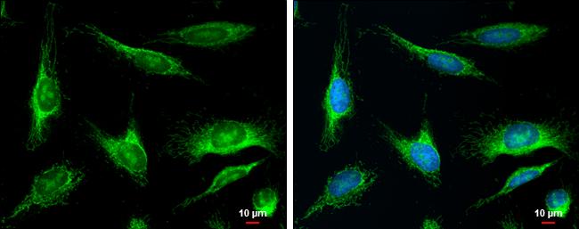 MUTYH Antibody in Immunocytochemistry (ICC/IF)