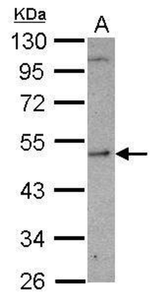 SHMT1 Antibody in Western Blot (WB)