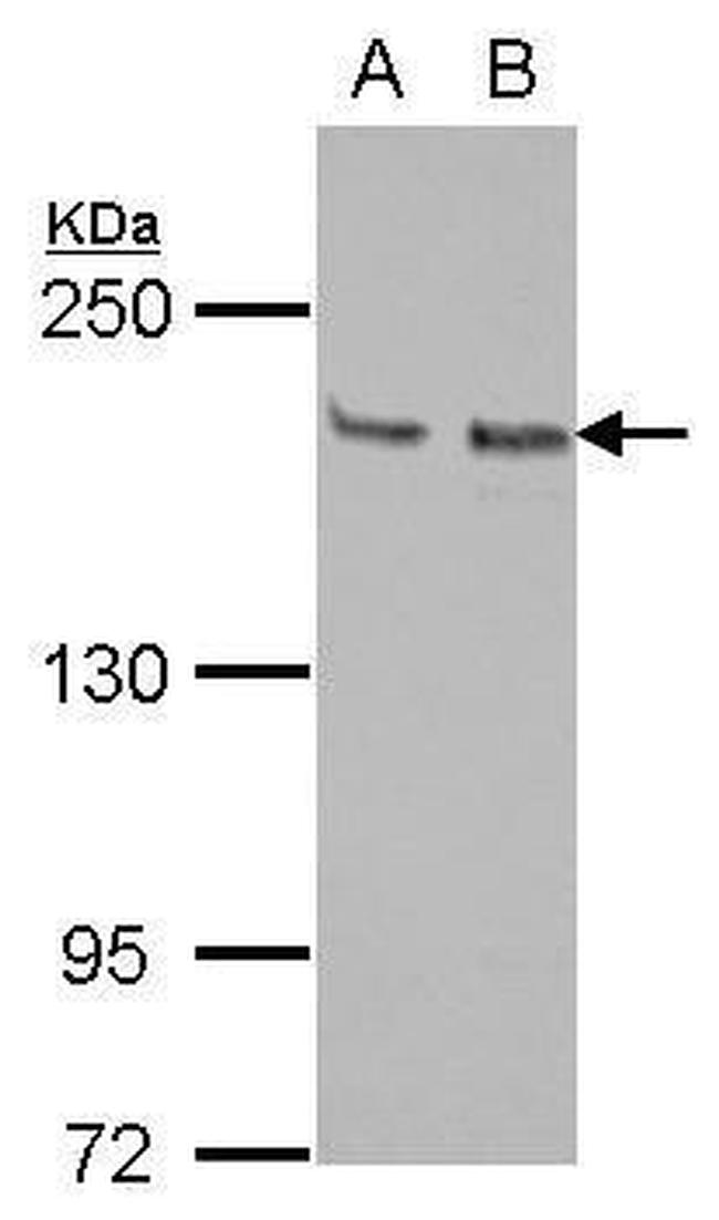 KIF14 Antibody in Western Blot (WB)