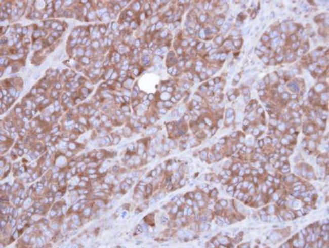 alpha Actinin 1 Antibody in Immunohistochemistry (Paraffin) (IHC (P))