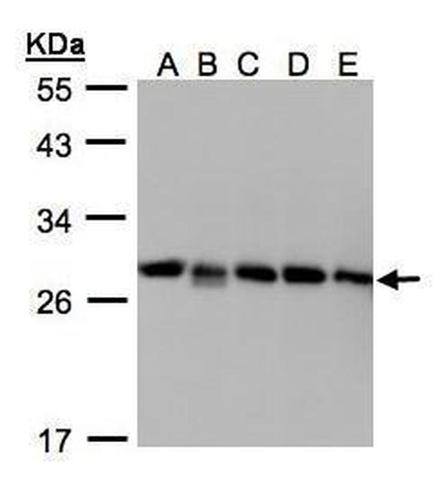 D4-GDI Antibody in Western Blot (WB)